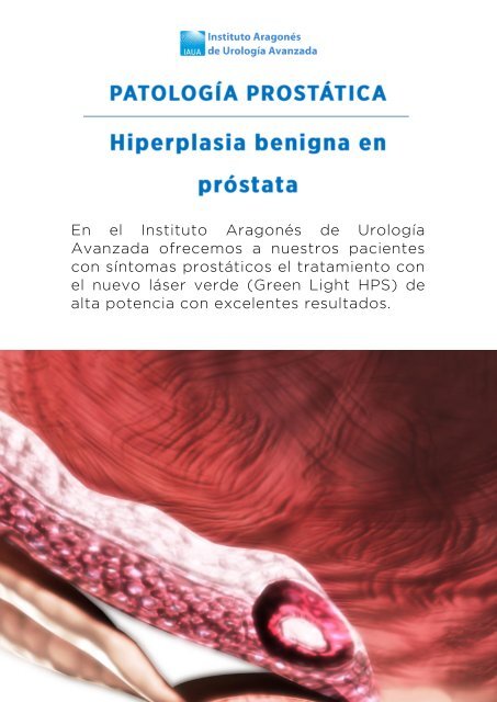 hiperplasia-benigna-prostata