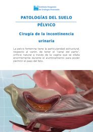 cirugia-incontinencia-urinaria