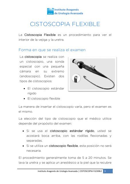 cistoscopia-flexible