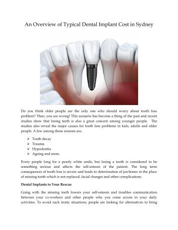 An Overview of Typical Dental Implant Cost in Sydney