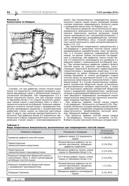  легкая с обл 