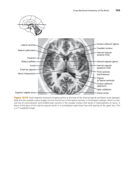 High-Yield Neuroanatomy 5e