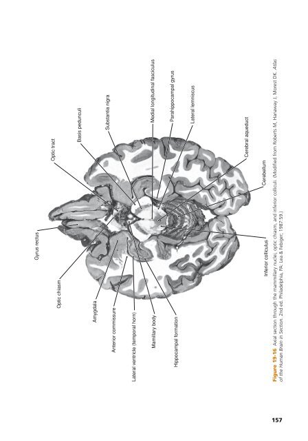 High-Yield Neuroanatomy 5e