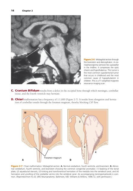 High-Yield Neuroanatomy 5e