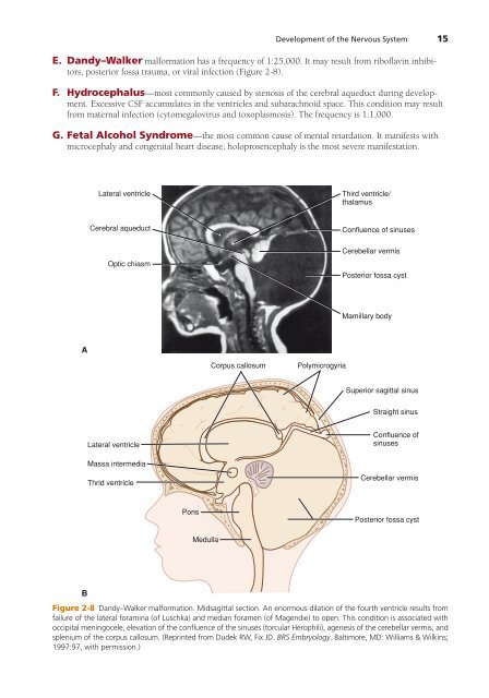 High-Yield Neuroanatomy 5e