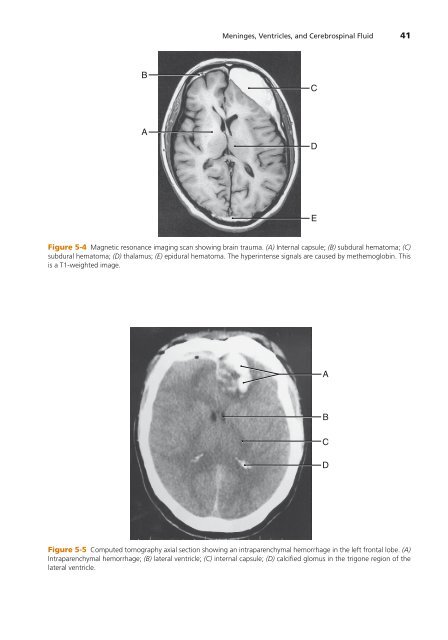 High-Yield Neuroanatomy 5e