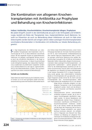 DI_4_2017_Artikel Barbeck et al_Anllografts+antibiotics Kopie