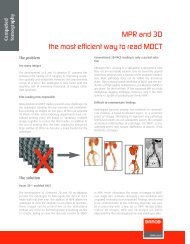 MPR and 3D the most efficient way to read MDCT - Barco