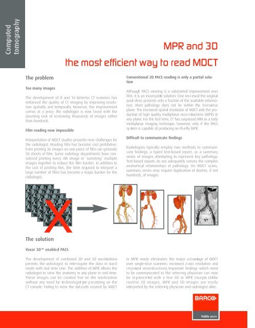 MPR and 3D the most efficient way to read MDCT - Barco