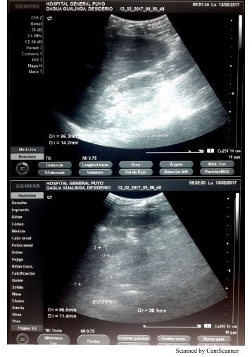 Imagenes de ecos caso Sra Garcia