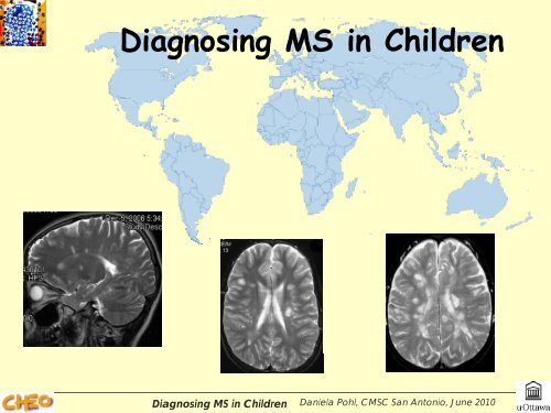 Diagnosing MS in Children g g