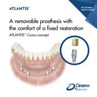 ATLANTIS Conus Concept