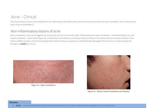 Acne and Rosacea Charity Training Manual