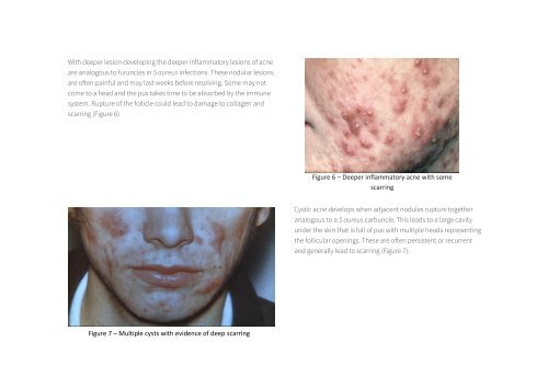Acne and Rosacea Charity Training Manual