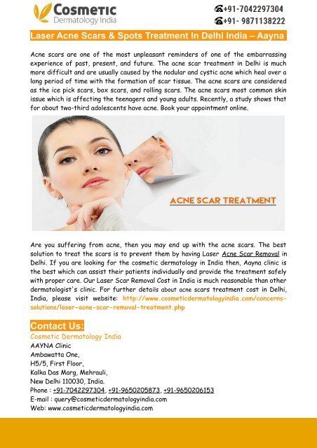 Laser Acne Scars &amp; Spots Treatment In Delhi India – Aayna
