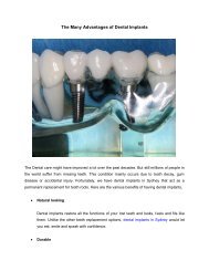 The Many Advantages of Dental Implants