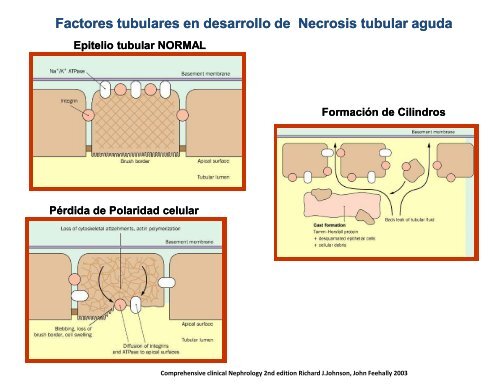 nefrologia modulo renal, liq y electrolitos, hta, diabetes  (1)