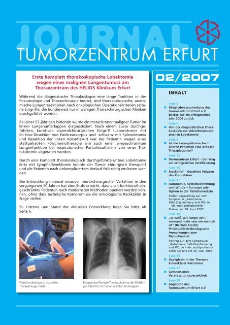 journal - Tumorzentrum Erfurt eV