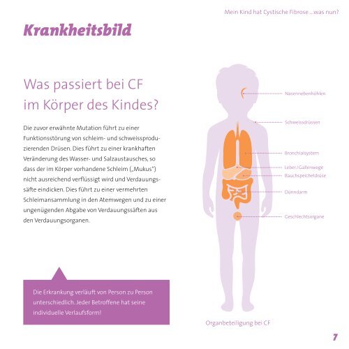 16240_vert_bro_diagnose_DE_rz02_mm Kopie