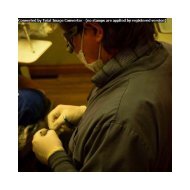 Spokane cosmetic dentist Dr. Keefe placing porcelain veneers