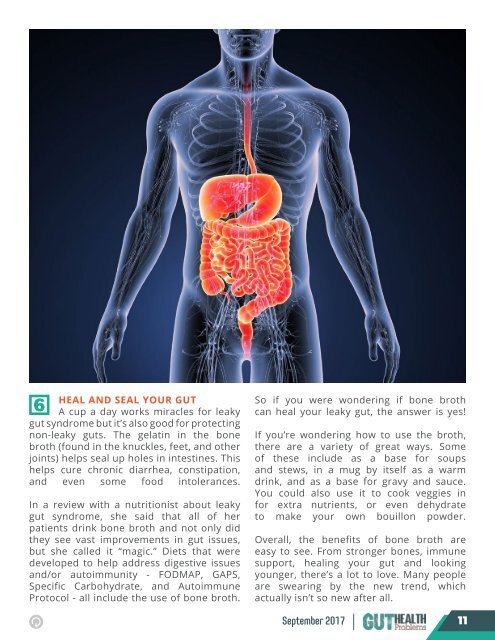 Gut Health Problems -  September 2017