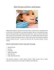 Useful Information and Guide on Dental Implants