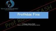 prothèse fixe1 - copie (f)
