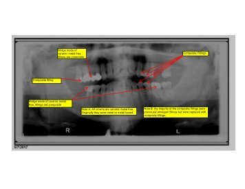 Eddie&#039;s Dental Panoramic X-Ray 9-7-2017