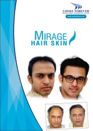 What is Mirage Hair Patch