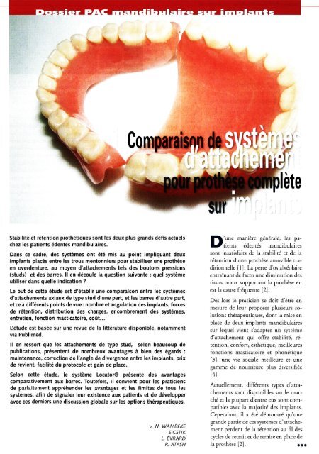 Comparaison de systèmes d&#039;attachement pour prothèse complète sur implant
