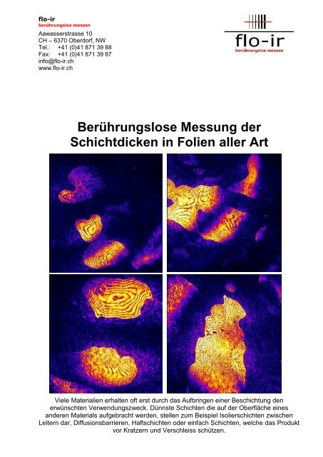 OCT-Schichtdickenmessung Komplettbeschrieb