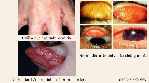 TÌM HIỂU HÌNH THÁI, SỰ CHUYỂN HÓA VÀ ĐỘC HỌC CỦA THỦY NGÂN TRONG MÔI TRƯỜNG