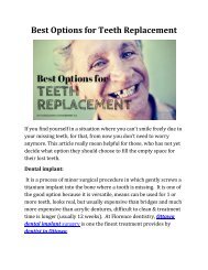 Best Options for Teeth Replacement