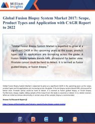 Global Fusion Biopsy System Market 2017 By Scope, Product Types and Application with CAGR Report  to 2022