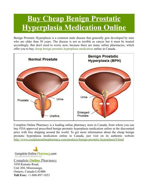 Buy Cheap Benign Prostatic Hyperplasia Medication Online