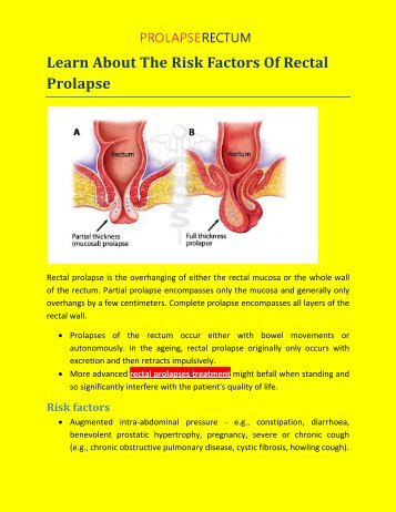 Learn About The Risk Factors Of Rectal Prolapse