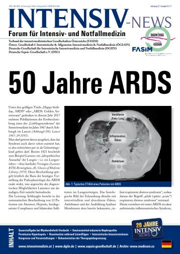 01 50 Jahre ARDS