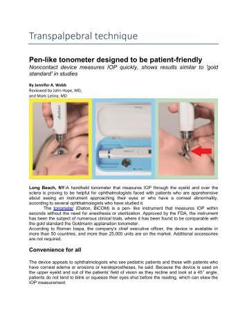 Pen-like tonometer designed to be patient-friendly - Transpalpebral Diaton tonometer measures IOP quickly shows results similar to 'gold standard' in studies