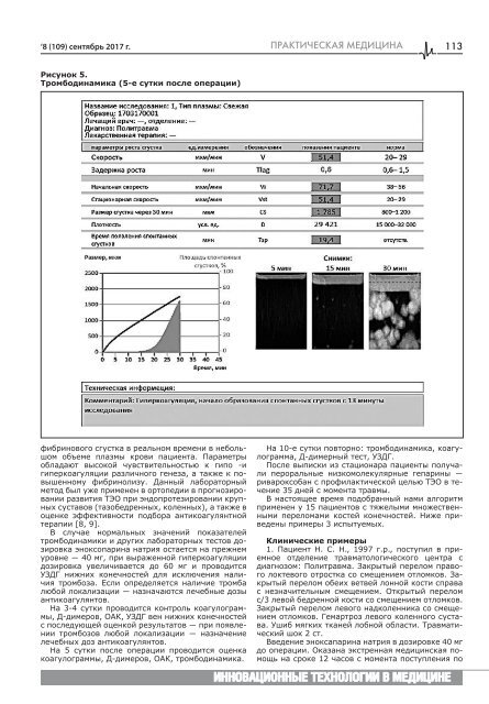  РКБ_Print 5mm