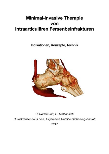 Manuskript MIOp Fersenbein Deutsch Final 2Dez17