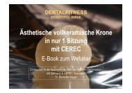 Ästhetische vollkeramische Krone in nur 1 Sitzung mit CEREC