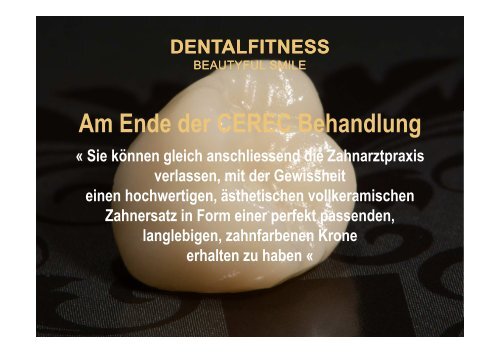 Ästhetische vollkeramische Krone in nur 1 Sitzung mit CEREC