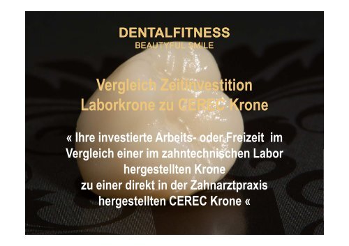 Ästhetische vollkeramische Krone in nur 1 Sitzung mit CEREC