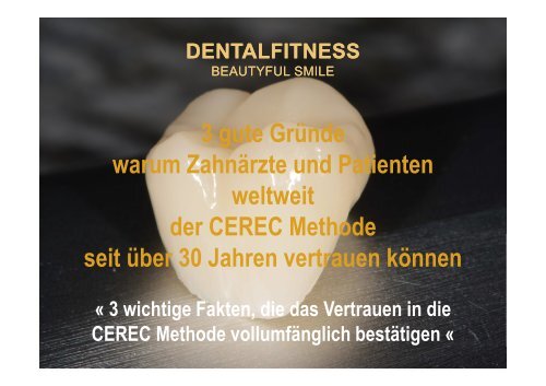 Ästhetische vollkeramische Krone in nur 1 Sitzung mit CEREC