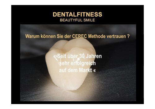 Ästhetische vollkeramische Krone in nur 1 Sitzung mit CEREC