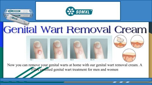 Wart Removal Products | Wartcream 