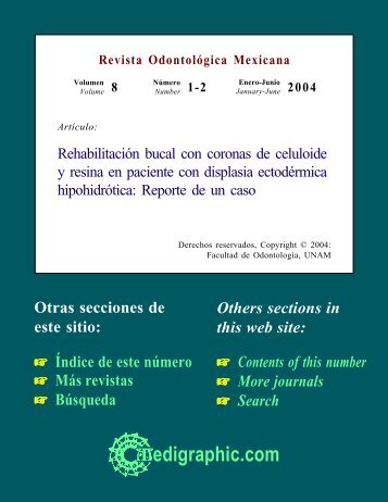 RehabilitaciÃ³n bucal con coronas de celuloide y ... - edigraphic.com