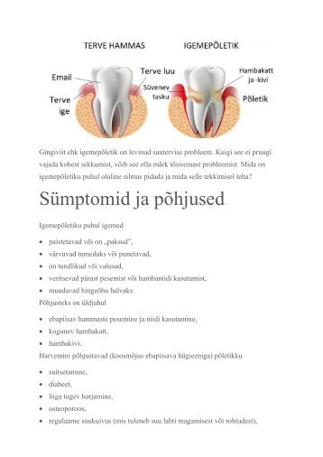 Gingiviit ehk igemepõletik on levinud suutervise probleem