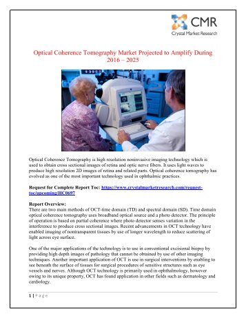 Optical Coherence Tomography Market is projected to be around USD 348 billion by 2025