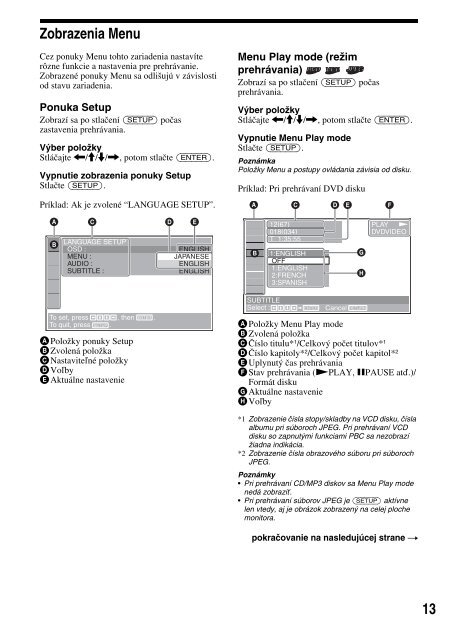 Sony MEX-R1 - MEX-R1 Consignes d&rsquo;utilisation Slovaque